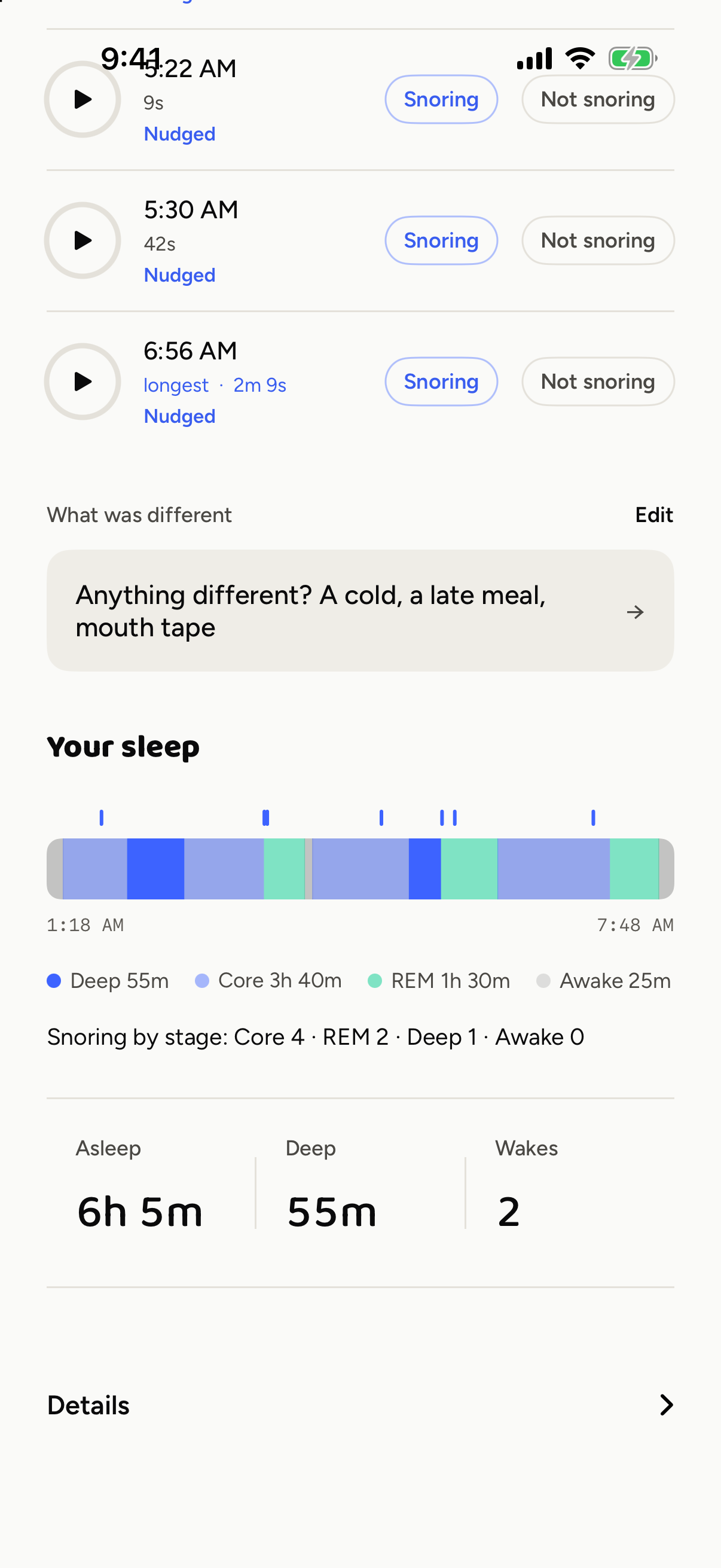 Sleep stage report